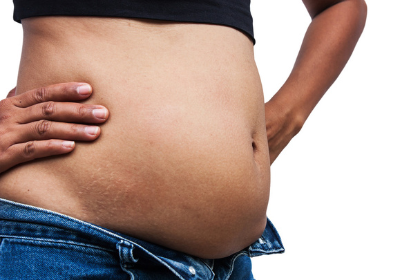 Mulheres com barriga gorda e estrias, frente Lado
 - Foto, Imagem