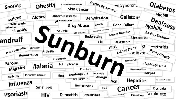A disease called Sunburn - Photo, Image