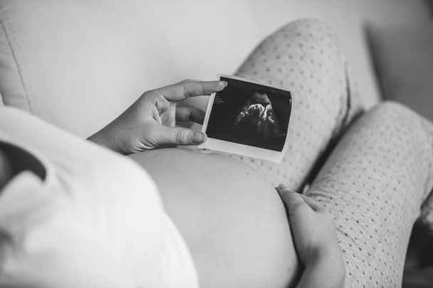 black and white photo of pregnant woman holding ultrasound scan - Photo, Image