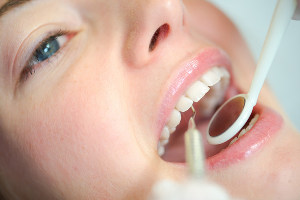 Close-up of woman s mouth at the dentist - Photo, image
