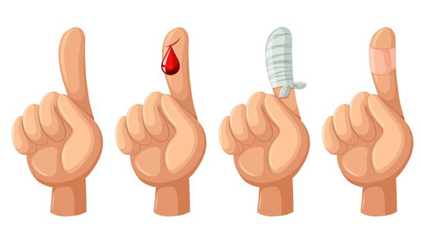 Палец с порезами и бинтами
 - Вектор,изображение