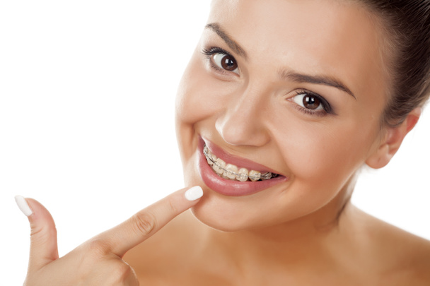 Hymyilevä nainen hammasraudoilla
 - Valokuva, kuva