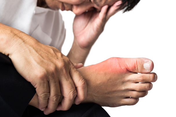 Homme avec la goutte douloureuse et enflammée sur son pied autour de la zone du gros orteil. - Photo, image