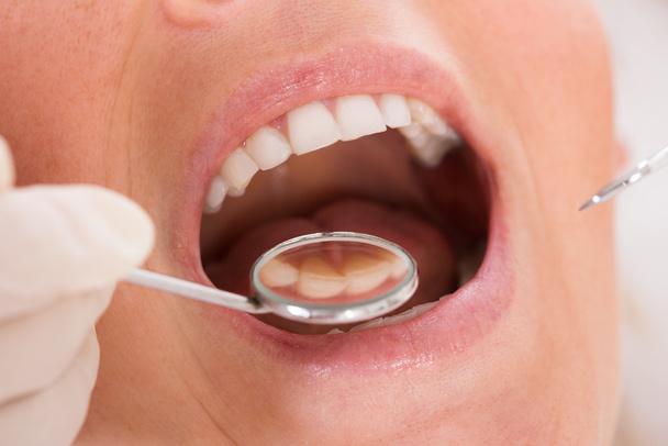 Nainen potilas saada hampaiden tarkistus
 - Valokuva, kuva
