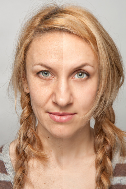 Retoque de beleza, antes e depois
 - Foto, Imagem