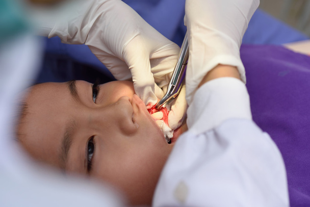 niño en extracción de dientes
 - Foto, Imagen