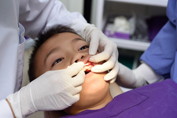 niño en extracción de dientes
 - Foto, Imagen