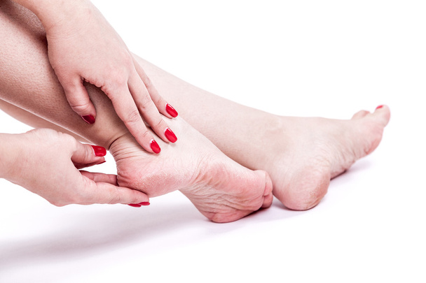 dry dehydrated skin on the heels of female feet with calluses - Photo, Image