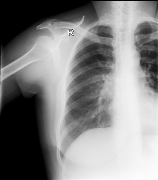 Imagem de raio-X do peito humano - Foto, Imagem