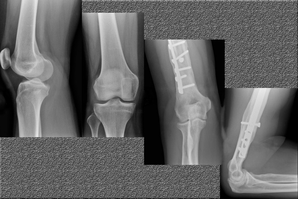 Imagem de raio-X do tórax humano para um diagnóstico médico
 - Foto, Imagem