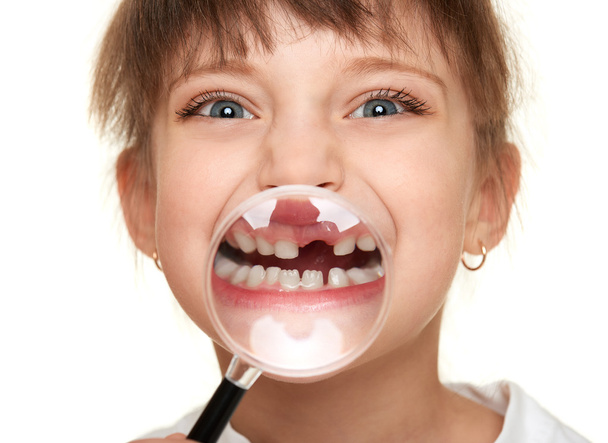 dívka Ukázat ztracené zuby přes zvětšovací sklo - Fotografie, Obrázek