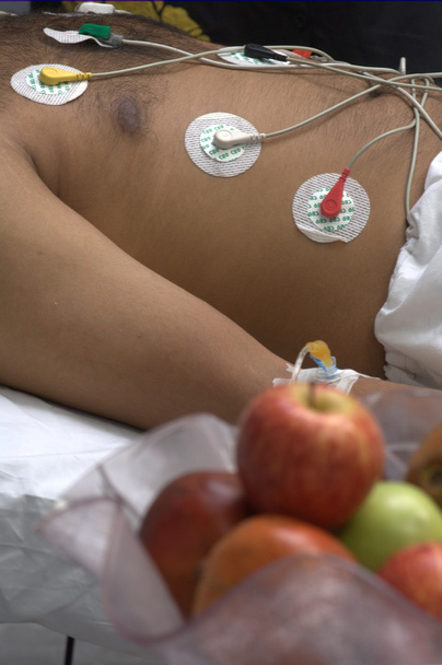 Fruits Apples in the hospital - Photo, Image