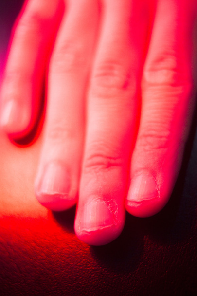 Rękę pacjenta w obróbce cieplnej czerwony fizjoterapii - Zdjęcie, obraz