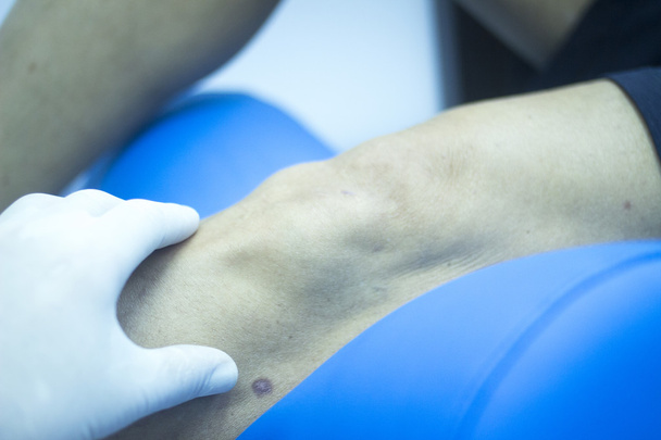 Нога пацієнта у фізіотерапії
 - Фото, зображення