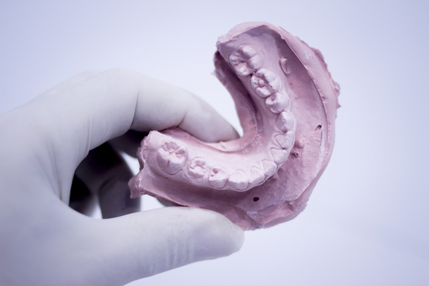 Dentistes moule dentaire dents d'argile plaque en céramique coulée
 - Photo, image