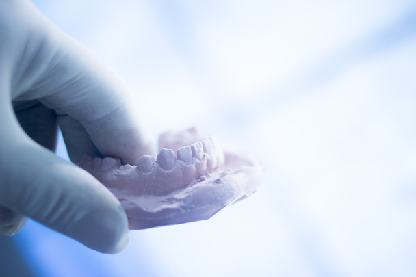 Οδοντιατρική μούχλα Οδοντίατροι πηλό δόντια κεραμικό πιάτο ρίχνει - Φωτογραφία, εικόνα