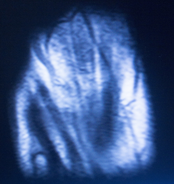 MRI mágneses Zengés Elképzelhető kéz ujj scan  - Fotó, kép