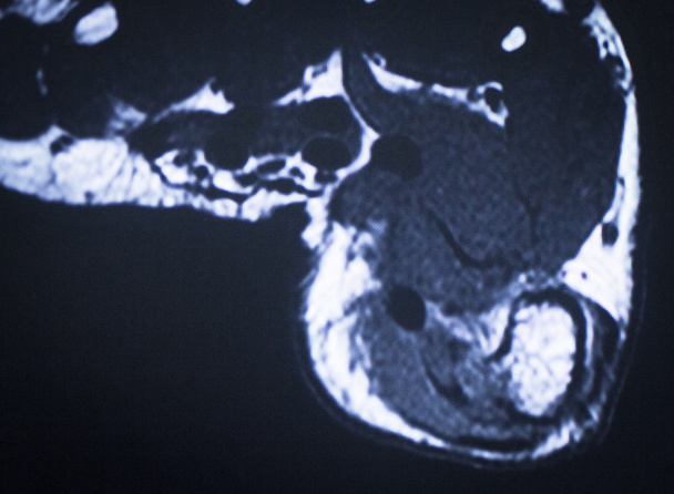 MRI magnetic resonance imaging voet tenen scan  - Foto, afbeelding