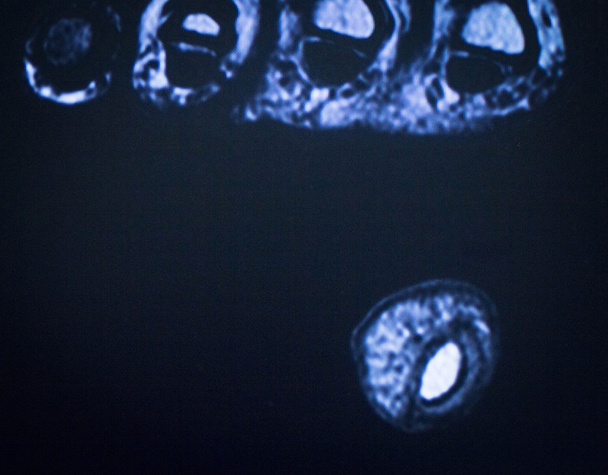 MRI magnetic resonance imaging foot toes scan  - Photo, Image