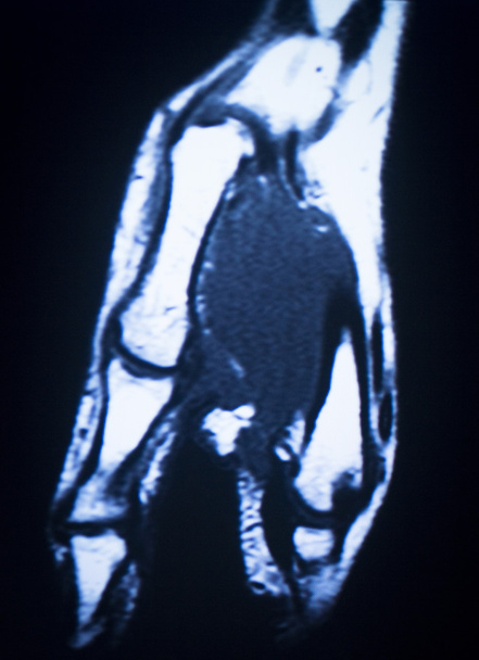 МРТ магнітно-резонансна томографія медичне сканування
  - Фото, зображення