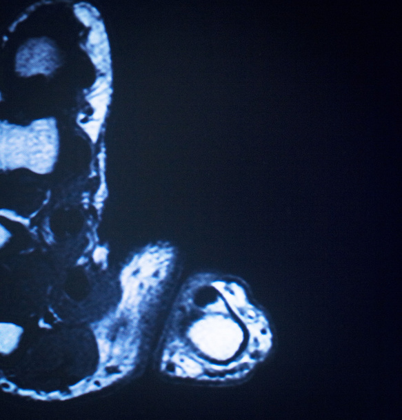 MRI magnetic resonance imaging voet tenen scan  - Foto, afbeelding