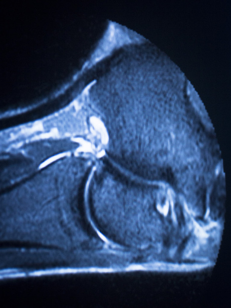 IRM imagerie par résonance magnétique balayage de cheville
  - Photo, image