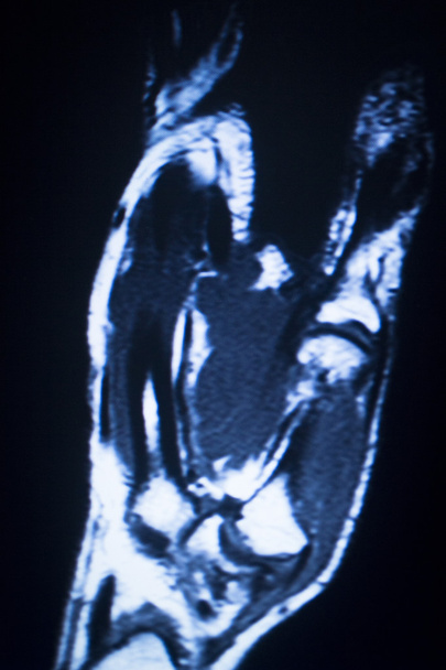 MRI magnetic resonance imaging-medische scan  - Foto, afbeelding