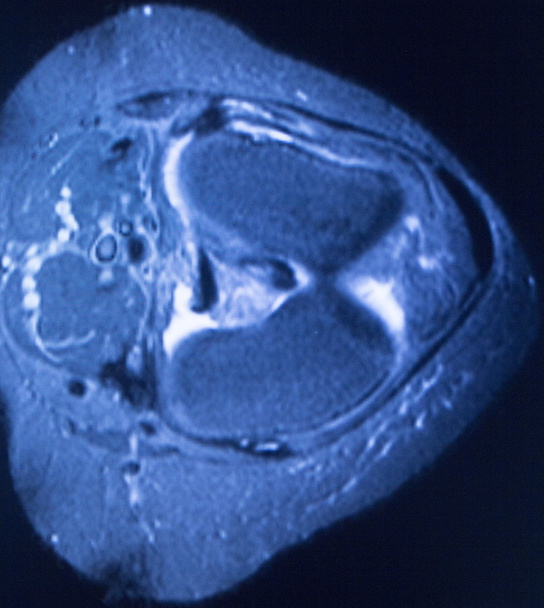 MRI magnetic resonance imaging medical scan  - Photo, Image