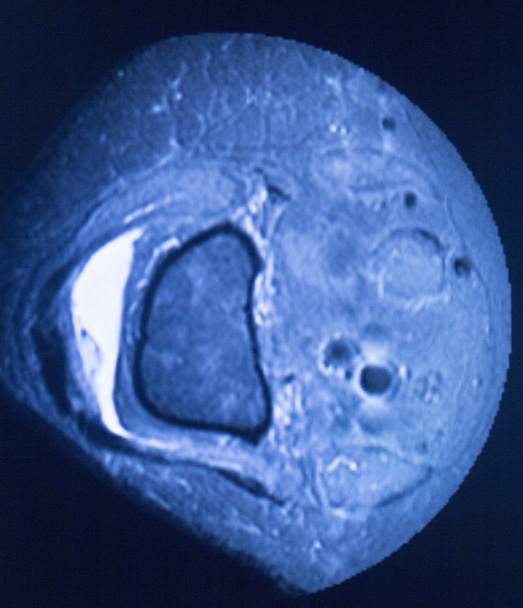 MRI magnetic resonance imaging medical scan  - Photo, Image