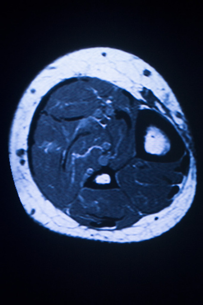 MRI magnetic resonance imaging-medische scan  - Foto, afbeelding