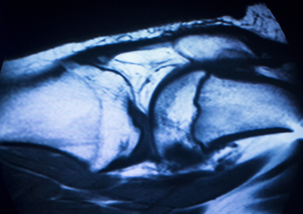 Mr manyetik rezonans görüntüleme tıbbi tarama  - Fotoğraf, Görsel