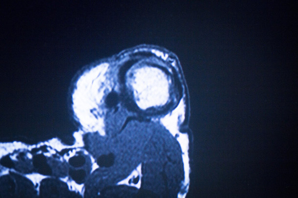 MRI magnetic resonance imaging foot toes scan  - Photo, Image