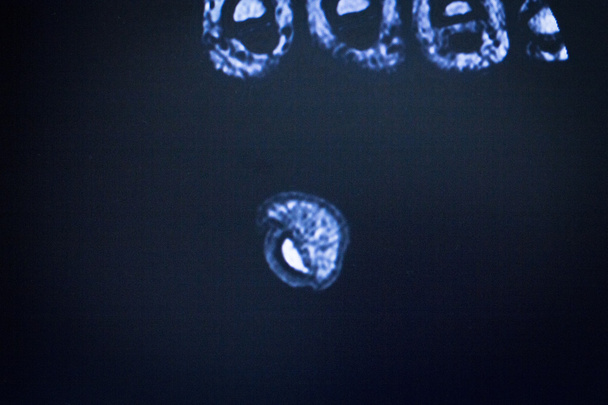 MRI magneettikuvaus jalka varpaat scan
  - Valokuva, kuva