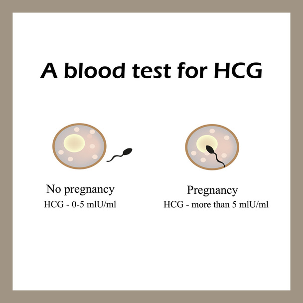 Un esame del sangue per l'hCG. L'esame del sangue per la gravidanza. Un ovulo fecondato. Infografica
 - Vettoriali, immagini