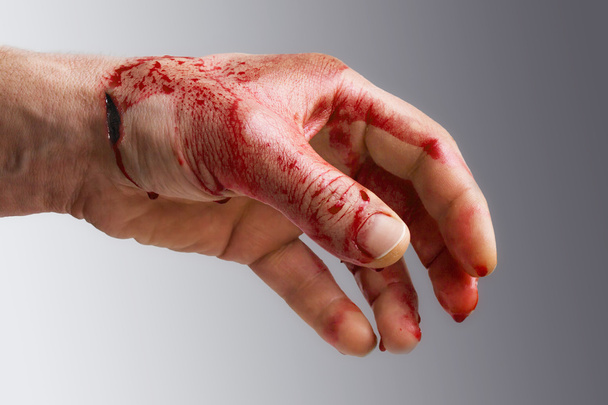 Bloody man's hand with a wound - Photo, Image
