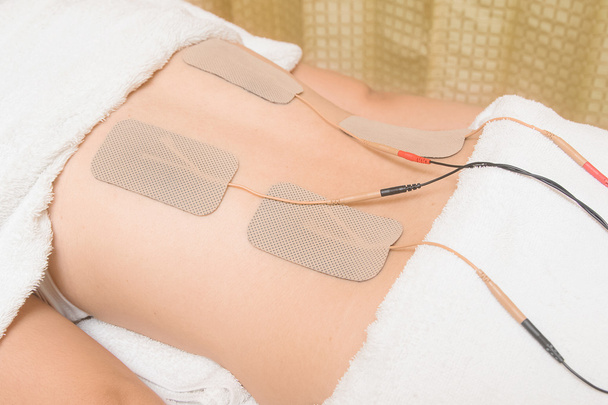Terapia de TENs, electrodos del dispositivo de las decenas en músculo de la espalda
 - Foto, Imagen