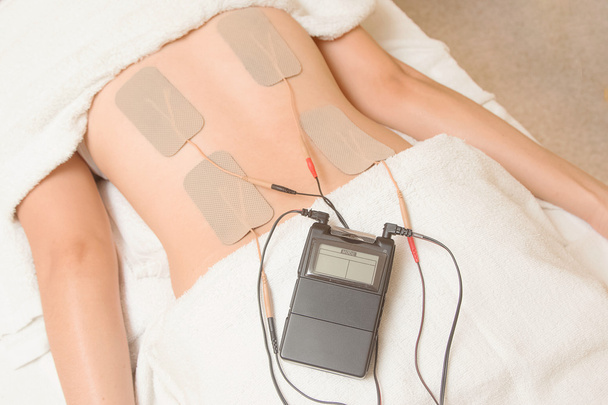 Terapia de TENs, electrodos del dispositivo de las decenas en músculo de la espalda
 - Foto, Imagen