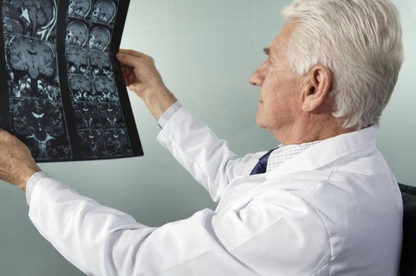 Arzt schaut auf mri scan - Foto, Bild