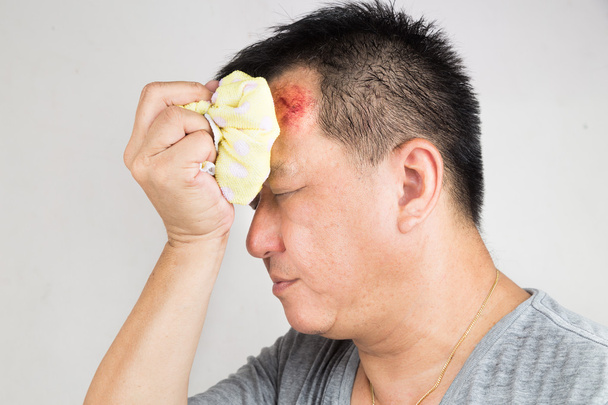 Man behandelen zijn gewonde pijnlijke gezwollen voorhoofd hobbel met icepack - Foto, afbeelding