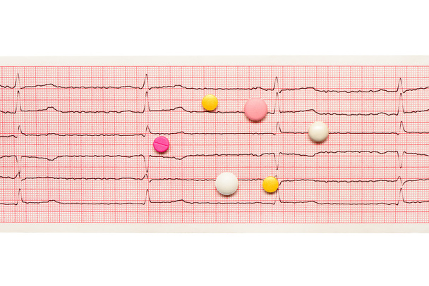 Beyaz, sarı ve pembe tablet EKG sonuçları kağıt üzerinde - Fotoğraf, Görsel