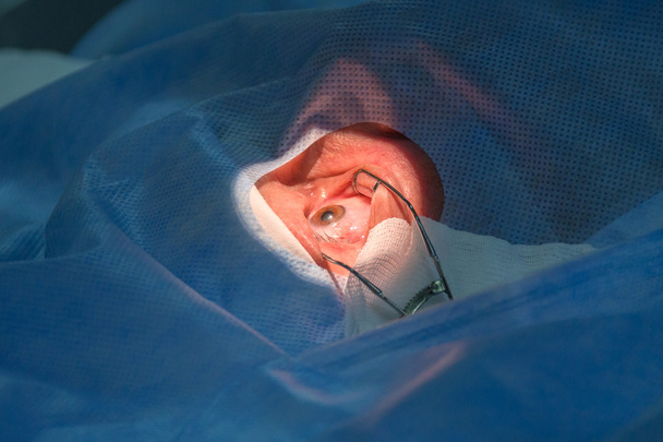 Uso de retractores Iris durante la operación oftalmológica
. - Foto, imagen