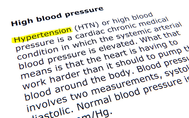 Wysokie ciśnienie krwi - Zdjęcie, obraz