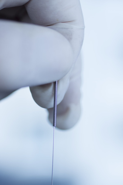Akupunktúrás tű száraz needling - Fotó, kép