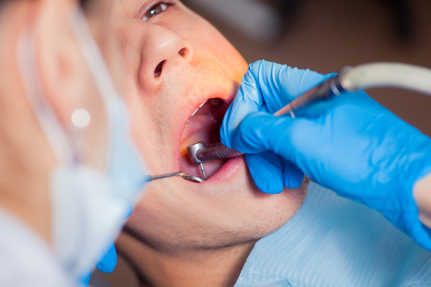 Homme ayant des dents examinées chez le dentiste traitement dentaire
 - Photo, image