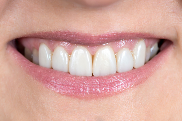 fechar de uma boca e dentes restaurados
 - Foto, Imagem