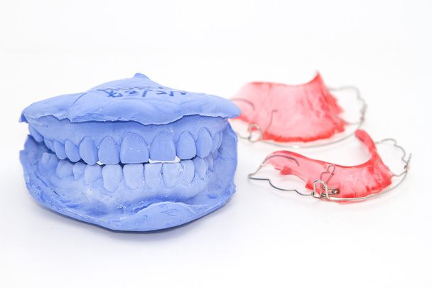 Prótesis dental y yeso modelo yeso sobre blanco
 - Foto, Imagen