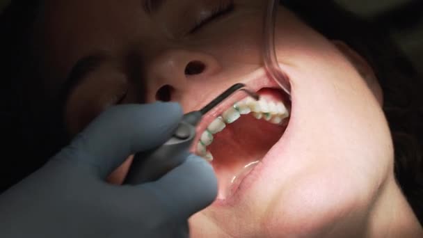 Scene from a visit to a dentist office - Footage, Video
