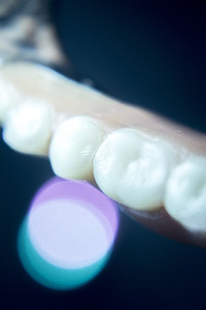 Prótesis dentales parciales dentales
 - Foto, imagen