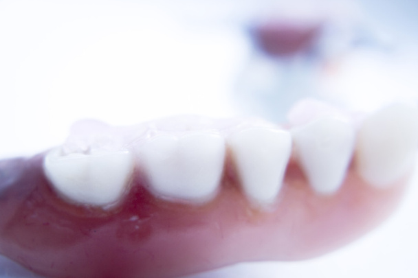 Prosthetic dental partial dentures - Photo, Image