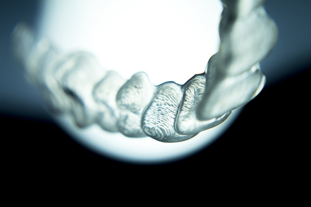 Soportes dentales soportes dentales soportes invisibles
 - Foto, imagen